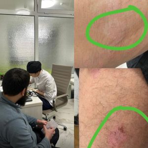 Консультация гастроэнтеролога